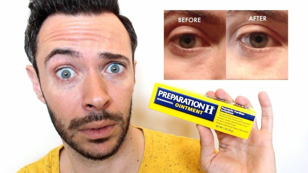 Does Preparation H Work for eye bags?